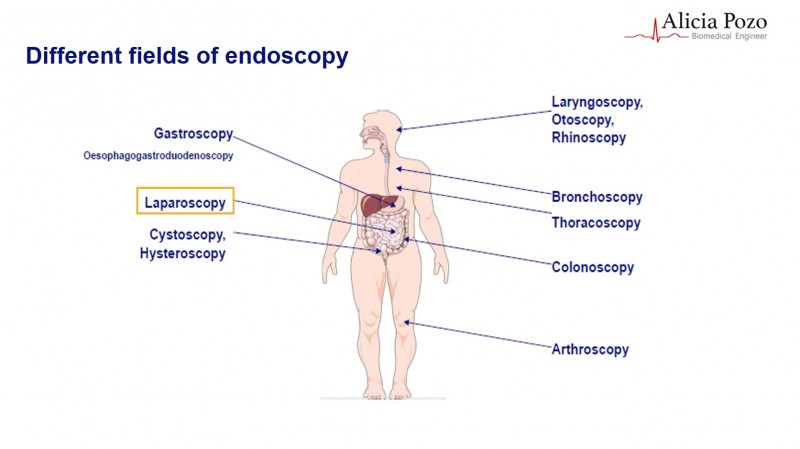 Endoscopy